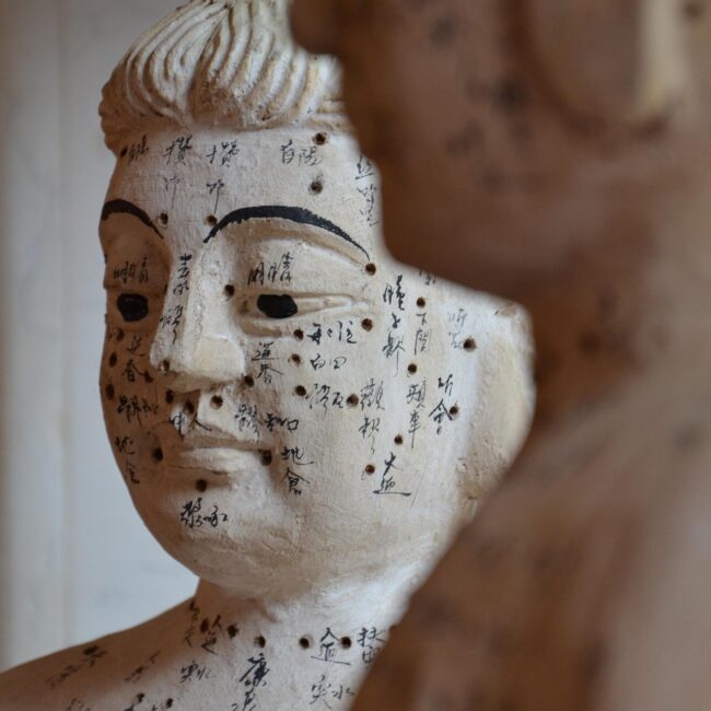 Agopuntura statua